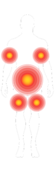 target areas thermowave slimming treatment sg